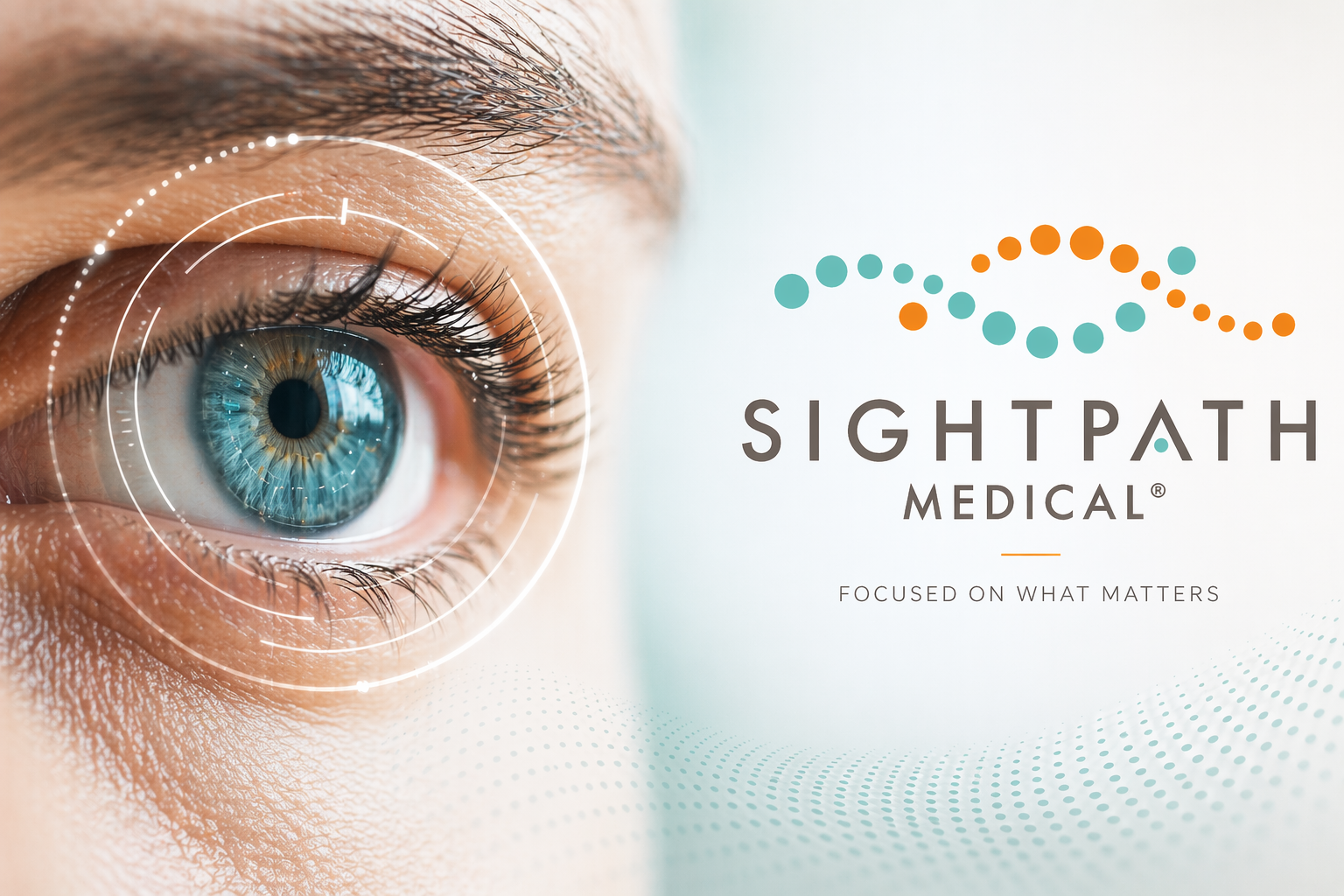 Close-up of an eye with the Sightpath Medical 'Focused on what matters' brand mark